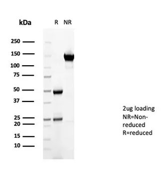 CD36 Antibody
