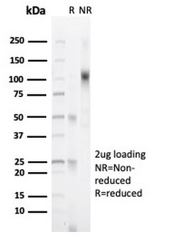 PGR Antibody