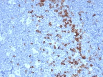 PDCD1 Antibody