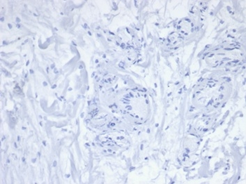 PDCD1 Antibody