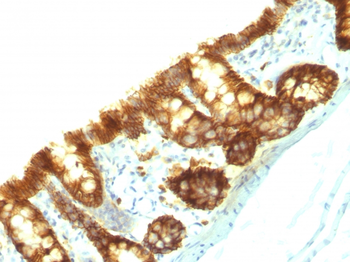 EPCAM Antibody