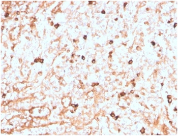 IGLV1-51 Antibody