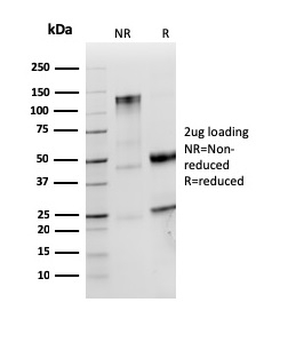 IGLV1-51 Antibody