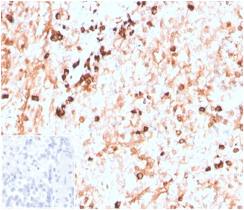 IGLV1-51 Antibody