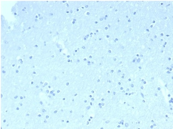 FCER2 Antibody