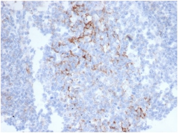 FCER2 Antibody