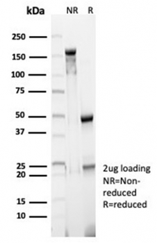 FCER2 Antibody