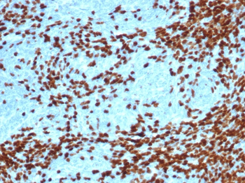 DNTT Antibody