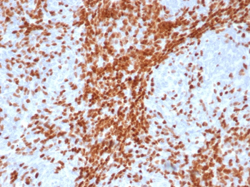 DNTT Antibody