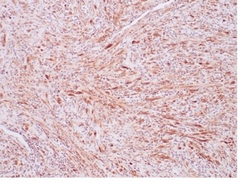 ALK Antibody