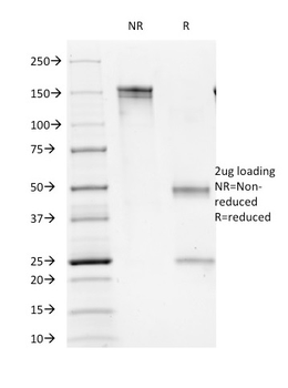 CD16 / FcγReceptor III Antibody
