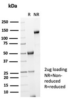 Recombinant Galectin-3 (LGALS3) (Thyroid Cell Marker) Antibody