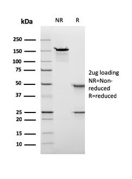 Recombinant Nuclear Antigen (Pan-Nuclear Marker) Antibody