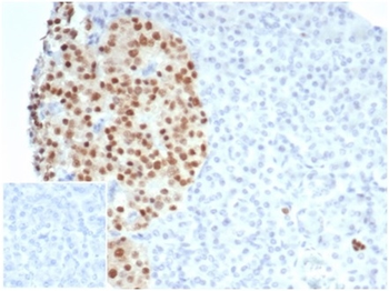 PAX6 Antibody