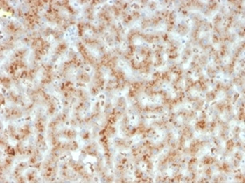 HP Antibody