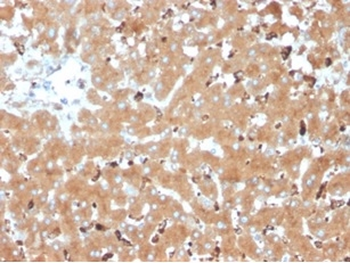 HP Antibody