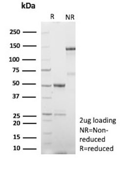 Recombinant Human Nuclear Antigen (HNA) (Human Cell Marker) Antibody