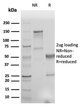 Recombinant Human Nuclear Antigen (HNA) (Human Cell Marker) Antibody