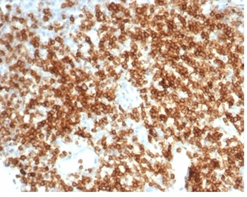 CD6 Antibody