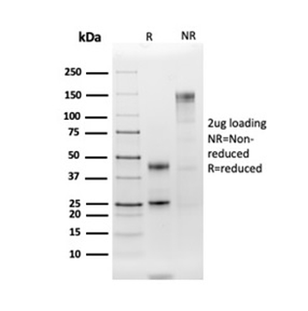 HLA-DRA Antibody