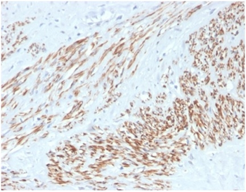 MYH11 Antibody