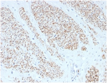 MYH11 Antibody