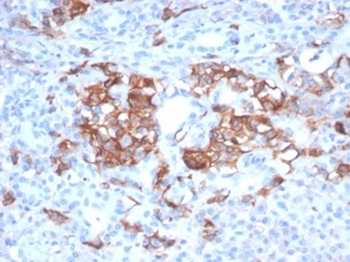 CD99 Antibody