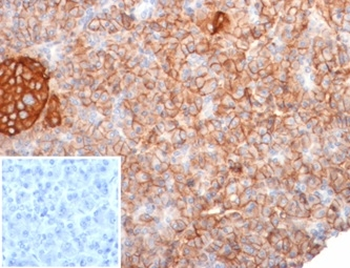 CD99 Antibody