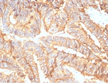 EPCAM Antibody
