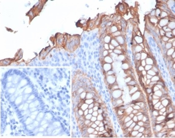EPCAM Antibody