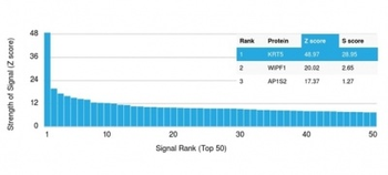 KRT5 Antibody