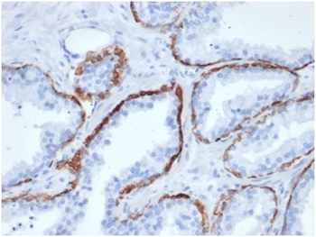 KRT5 Antibody