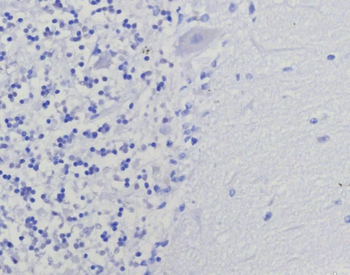 TYMS Antibody