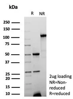 KRT15 Antibody