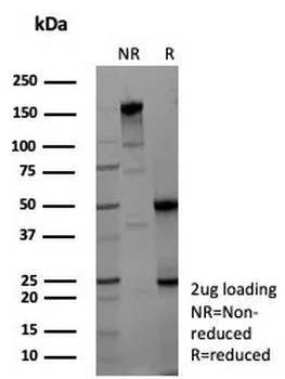 ENO2 Antibody