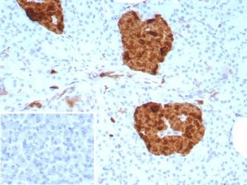 ENO2 Antibody