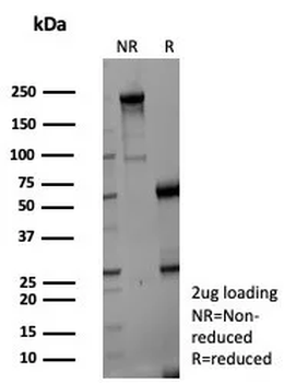 ENO2 Antibody