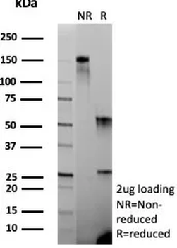 CASP7 Antibody
