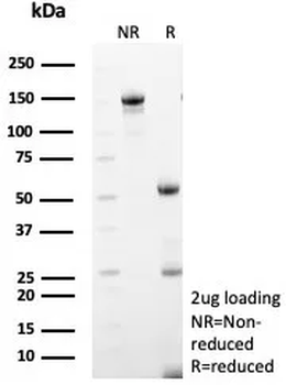 COL4A5 Antibody