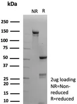 CNN1 Antibody