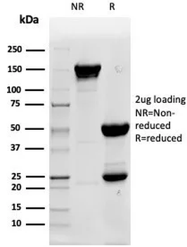 ALPP Antibody