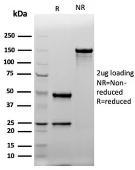 KRT20 Antibody