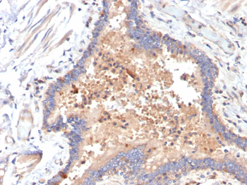 IL-6 Antibody