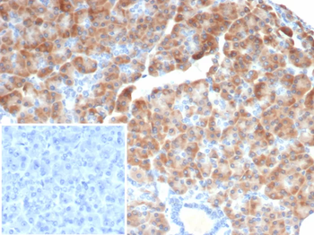 IL-6 Antibody