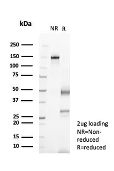 IL-6 Antibody