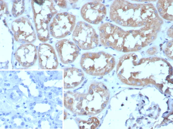 ADCY8 Antibody