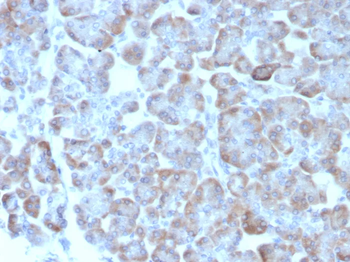 ADCY8 Antibody