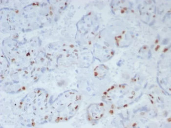 CDKN1C Antibody