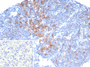 PIK3CD Antibody