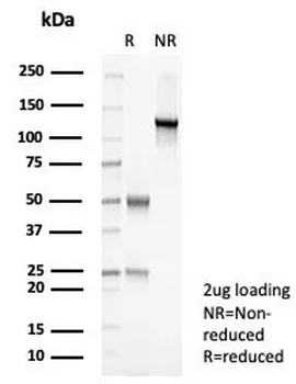 SLC45A3 Antibody